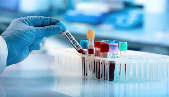 LAB